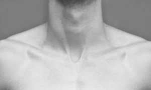 intervention chirurgie esthétique poitrine pour homme