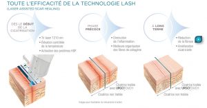 optimisation cicatrisation