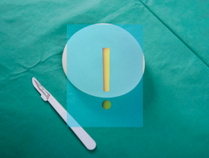 implant mammaire Nantes