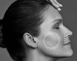 Femme de profil les yeux fermés illustrant les zones d'injection NCTF 135 HA pour la revitalisation de la peau du visage, traitement réalisé en cabinet à Nantes